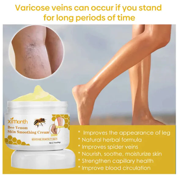 Relieve Leg Soreness And Swelling And Smooth Vascular Bulge Vein Neck Cream